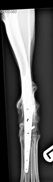 Figure 4. Six-week post-operative craniocaudal view